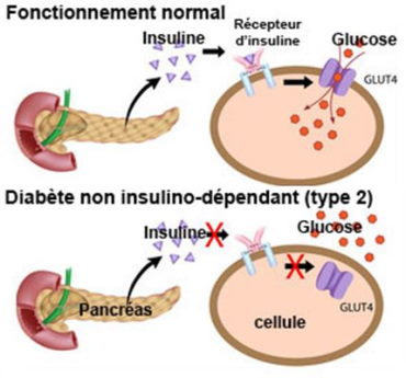 Quelles plantes prendre pour traiter un diabète débutant phyto soins